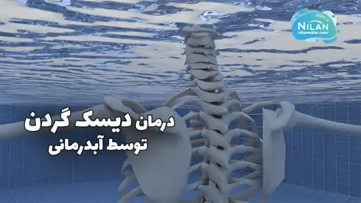 درمان دیسک گردن توسط آب درمانی