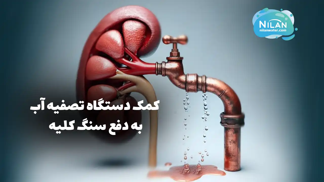 چگونه دستگاه تصفیه آب به دفع سنگ کلیه کمک میکند