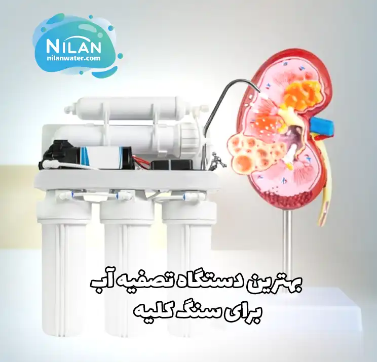 بهترین دستگاه تصفیه آب برای سنگ کلیه