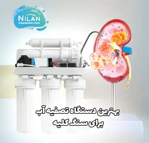 بهترین دستگاه تصفیه آب برای سنگ کلیه